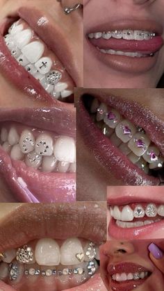 many different pictures of teeth with various jewels on them