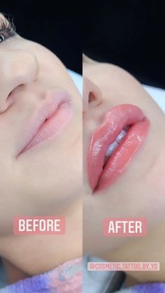 Tattooed Lips Before And After, Lip Tattoo Before And After, Lipblush Before And After, Lip Blushing Tattoo Healing, Lip Blushing Before And After, 1 Ml Lip Filler Before And After, Lip Tattoo Cosmetic, Permanent Lip Color Tattoo, Lip Blushing Tattoo Colors