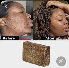 Curly Taper, Skin Lighting, Raw African Black Soap, Face Treatments, Cabello Afro Natural, Bday Wishlist, Medical Herbs, Natural Skin Care Remedies, Unrefined Shea Butter