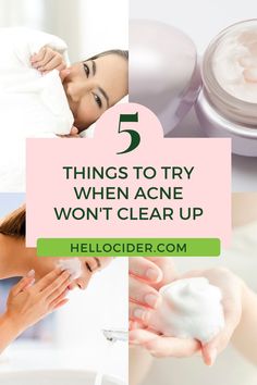 Acne can be overwhelming. We are sharing 5 easy tips to achieve clear skin on the blog. Learn how to get rid of acne and get clear skin without the need for more harsh skin products that dry out your skin and cause even more acne. natural acne treatment | acne treatment products | how to clear acne Acv For Acne, Get Rid Of Acne Fast, Natural Remedies For Acne, Cystic Acne Remedies, Vinegar Benefits, Acne Medicine, Forehead Acne, Acne Overnight