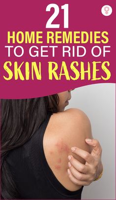 Itching Skin Remedies, Natural Rash Remedies, Essential Oils For Rash, Face Rash Remedies, Skin Rash On Face, Skin Rash Remedies, Home Remedies For Rashes, Types Of Skin Rashes, Itching Remedies