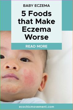 In the blog, the skincare experts at Eco Chic Movement are sharing tips about how to soothe your child's eczema. When it comes to natural treatments for baby eczema, that actually work, the key is to get to the root cause of the problem. And that starts by understanding what eczema really is. We share details so you can understand eczema and share our tips for soothing it for our baby. Natural Skin Care Products | Skin Concern | Eczema | Skin Care Tips Excema Diet For Kids, Excema Remedies For Kids, Baby Excema, Natural Skin Care Products, Dry Skin Patches, Health Talk, Exercise Tips, Parenting 101, Eco Chic