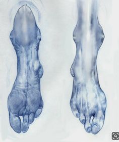 an x - ray image of the foot and ankle area in blue ink on white paper