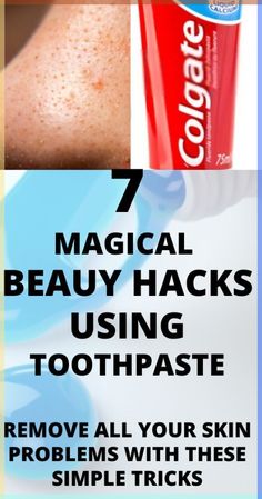 We all use toothpaste at home for our teeth but you'll be surprised to know these amazing beauty hacks for solving your skin problems like Pimples, Blackhead... Toothpaste Hacks, Dark Knees And Elbows, Whiteheads Removal, Dark Knees, Nail Whitening, How To Remove Blackheads, Get Rid Of Pimples, Colgate Toothpaste, To Remove Blackheads