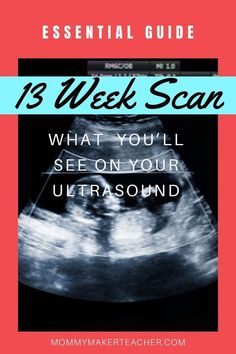 an x - ray image with the text 13 week scan what you'll see on your ultrasound