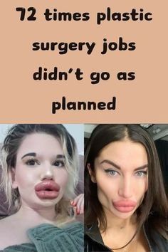 two women making funny faces with the caption that says, 17 times plastic surgery jobs didn't go as planned