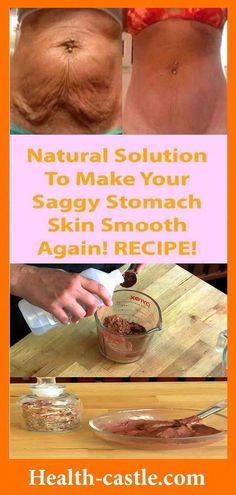 Tighten Stomach, Skin Tightening Stomach, Tighten Loose Skin, Skin Bumps, Saggy Skin, Natural Health Tips, Loose Skin, Sagging Skin, Skin Tightening