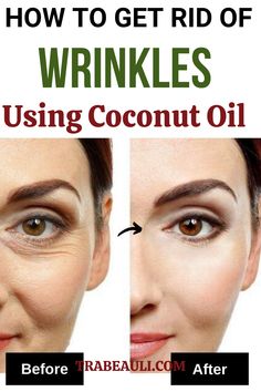 get rid of wrinkles Home Remedies For Wrinkles, Diy Wrinkles, Under Eye Wrinkles, Skin Care Wrinkles