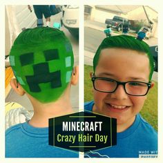 MINECRAFT Crazy Hair Day- Adam Crazy Hat Day, Acne Treatments, Crazy Hats, Crazy Day, Crazy Hair Day At School