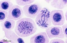 an image of some purple cells in the cell