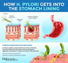 H pylori is an opportunistic bacteria that can infect and spread rapidly in individuals with a compromised immune system. H Pylori Symptoms, H Pylori, Gram Negative Bacteria, Mastic Gum, Poor Digestion, Body Connection, Iron Deficiency