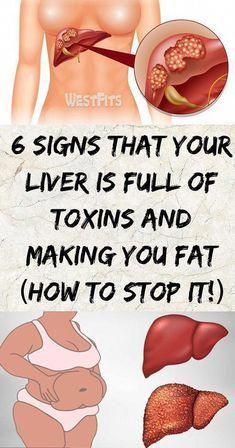 Autogenic Training, Natural Liver Detox, Liver Detox Diet, Detox Your Liver, Cleanse Your Liver, Full Body Detox, Liver Diet, Healthy Liver, Liver Detox