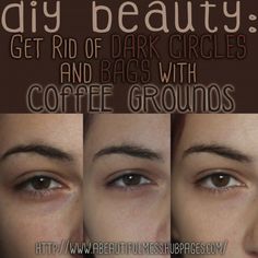 Undereye Bags, Dark Circles Makeup, Homemade Eye Cream, Make Up Foundation, Face Cream For Wrinkles, Natural Acne Remedies, Dark Circles Under Eyes