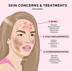 #skinconcerns #treatment Cosmetic Making, Face Workout, Skincare Recommendations, Selfcare Tips, Face Routine, Skin Advice, Skin Care Routine Order, Basic Skin Care Routine