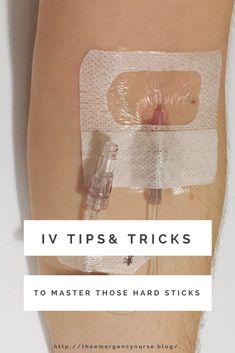 an iv device attached to the back of a woman's leg with text overlay that reads iv tips & tricks to master those hard sticks