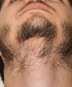 Facial Hair Growth For Men, Patchy Beard Styles For Men, How To Grow A Beard, Patchy Beard Styles, Best Beard Growth, Facial Hair Growth, Patchy Beard