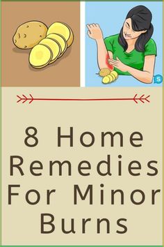 8 Home Remedies for Minor Burns, Nourish Your Skin Without #Burn_Relief_Skin #Burned_Skin_Remedies #Natural_Remedies_For_Burns #Curling_Iron_Burn Burn Relief Skin, Burned Skin Remedies, Natural Remedies For Burns, Curling Iron Burn, Home Remedies For Burns, Burn Remedy, Burn Care, Burn Relief