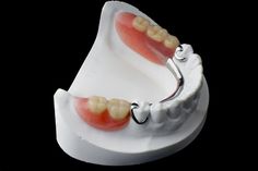 Advantages And Disadvantages Of #PartialDentures For Your Daily Living Denture Repairs, Affordable Dentures, Dental Implants Cost