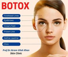 Botox Forehead, Botulinum Toxin, Dancer Workout, Chronic Migraines, Excessive Sweating, Men's Health Fitness, Skin Clinic