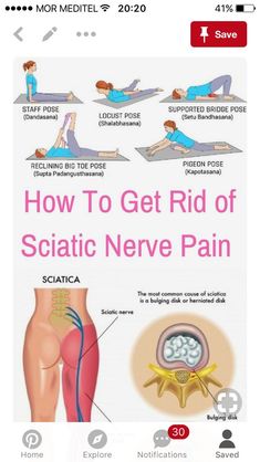 the diagram shows how to get rid of sciatic neve pain