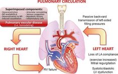 the heart and lungs are labeled in this diagram