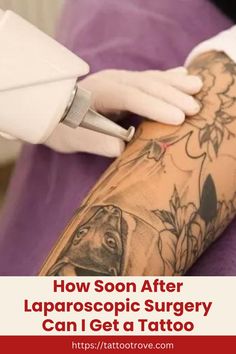 how soon after laparoscopic surgery can i get a tattoo Surgery Tattoo, Aztec Tattoos Sleeve, Geometric Mandala Tattoo, Full Sleeve Tattoo Design, Laparoscopic Surgery, Getting A Tattoo, Healing Tattoo, Drinking Alcohol