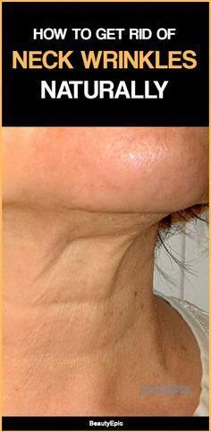 Tighten Neck Skin, Neck Wrinkles, Saggy Skin, Loose Skin