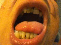 a close up of a person's mouth with food in the shape of teeth