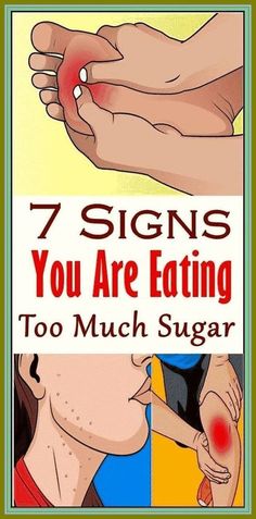 Just 7 Signs You Are Eating, Too Much Sugar Too Much Sugar, Eating Too Much, Low Blood Sugar, Lack Of Energy, Ate Too Much, Gluten Intolerance, Healthy Skin Tips, Healthy Beauty, Sugar Cravings