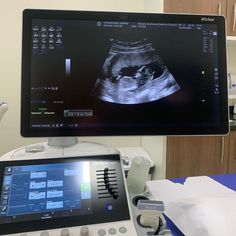 an x - ray image is displayed on a monitor in a hospital room with medical equipment