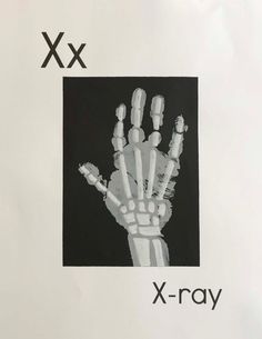 an x - ray hand is shown in black and white with the words x - ray on it