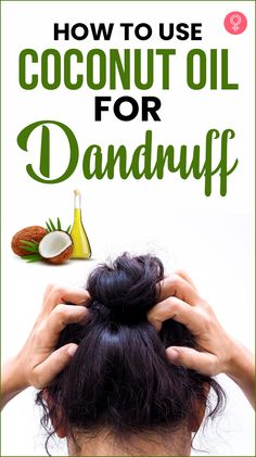 Coconut Oil Remedies, Natural Dandruff Remedy, Coconut Oil Mask, Diy Coconut Oil, Best Hair Care