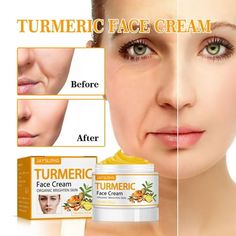 Turmeric Firming Skin Cream Wrinkle Reducing Cream 50g Dry Skin Tightening Women's Line Wrinkle Firming And Antis Aging Cream Features: Yellow Firming Skin : This is a perfect moisturizing firming skin for the face. It provides women with powerful -aging, wrinkle reduction, face lift and firming. -Wrinkle for Women's Face: This is an -wrinkle lotion for women that visibly relieves rough skin, provides a nice smoothing effect, reduces wrinkles, reduces signs of aging, and helps you have a truly s Dark Spot Corrector Serum, Organic Face Cream, Turmeric Face, Dark Spot Corrector, Serum Cream, Face Wrinkles, Anti Aging Serum, Anti Aging Cream, Skin Cream