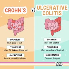 the differences between crohn's and ulcerative cortitis info