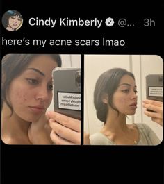 Cindy Kimberly, Cute Makeup Looks, Pretty Skin, Glow Up Tips, Lifestyle Inspiration, Cute Makeup, Just Girly Things, Simple Makeup, Food Food