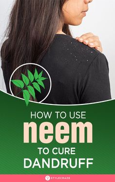 Neem Hair Mask, Haircare Dandruff, Dandruff Home Remedies, How To Remove Dandruff, Neem Leaves, Home Remedies For Dandruff, Dandruff Hair, Dandruff Remedy, Getting Rid Of Dandruff