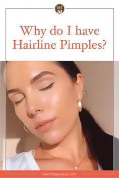 Hairline acne on your scalp? Greasy hair? There’s no need to panic: First, take a quick inventory and figure out what’s causing it. Hairline Acne, Scalp Pimples, Pimple Under The Skin, Pimples On Scalp, Severe Dandruff, Painful Pimple, Scalp Acne, Pimple Causes, Pimples On Forehead