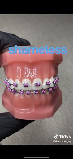 Hello Kitty Braces, Pretty Braces Colors, Hot Pink Braces, Purple Braces, Behel Gigi, Braces Transformation