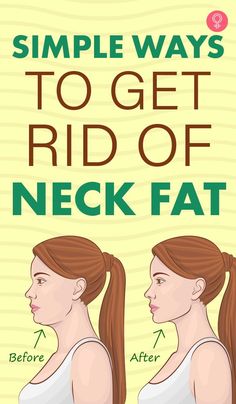 Simple Ways To Get Rid Of Neck Fat: If you don’t want to resort to medical treatments, there are some easy ways to get rid of neck fat naturally. Read this article to find out some of the foods and exercises you can try to get rid of your neck fat. #weightloss #neckfat #health #fitness Makeup Tip, Visceral Fat, Reduce Body Fat, Diet Keto, Double Chin, Lose 50 Pounds, Stubborn Belly Fat, Diet Tips, Lose Belly