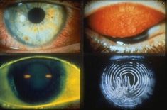 four different colored images of an eye