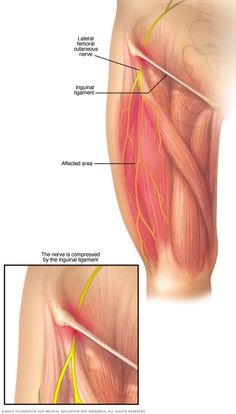 Sciatic Nerve Stretches, Femoral Nerve, Leg Pain, Body Anatomy