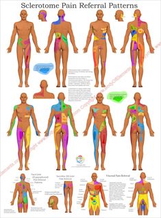 Healthcare Poster, Lower Back Pain Remedies, Middle Back Pain, Reflexology Chart, Back Pain Remedies, Upper Back Pain, Reference Chart