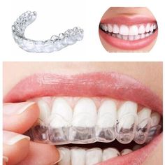 Braces Retainer, Retainer Teeth, Teeth Clenching, Dental Retainer, Night Guard, Remedies For Tooth Ache, Teeth Whitening Strips, Yellow Teeth