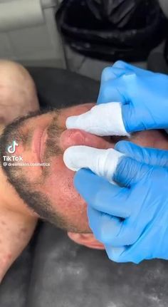 a man with blue gloves is getting his teeth checked