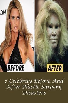 the before and after pictures of celebrity plastic surgery for women over 50 years old, including an image of a woman's face