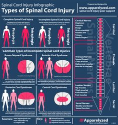 Incomplete spinal cord injury infographic by Apparelyzed. Pt School, Spinal Cord Injuries, Physical Therapist Assistant, Physical Therapy Assistant, Pta School, Pa School, Spinal Injury, Medicine Student, Acute Care