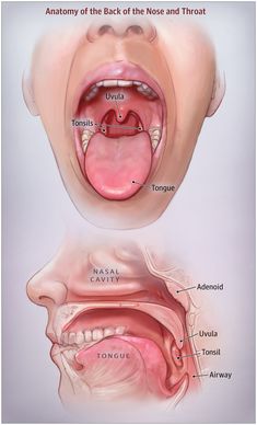 the anatomy of the mouth and throat, with labels on how it is used to treat