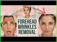 There are various reasons  that cause deep forehead wrinkles. It has Face yoga exercises for forehead, home remedies and lifestyle tips to remove forehead wr...#Hide_Forehead_Wrinkles #Forehead_Wrinkles_Remedies #Remove_Forehead_Wrinkles #Deep_Forehead_Wrinkles Forehead Wrinkles Remedies, Hide Forehead Wrinkles, Remove Forehead Wrinkles, Deep Forehead Wrinkles, Face Wrinkles Remedies, Chin Exercises, Face Yoga Exercises, Face Yoga Facial Exercises, Facial Yoga