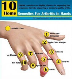 Joints Pain Remedy, Arthritic Pain, Natural Therapy, Quality Of Life, Natural Home, Natural Home Remedies, Natural Medicine, Health Remedies, Home Remedies