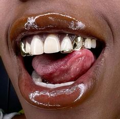 dm for credit or removal Gold Teeth Grillz, Girl Grillz, Silver Grillz, Dental Jewelry, Gold Grillz